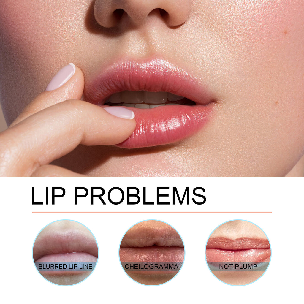 Close-up of hydrated pink lips and three comparison circles showing common lip issues like lines and lack of volume.