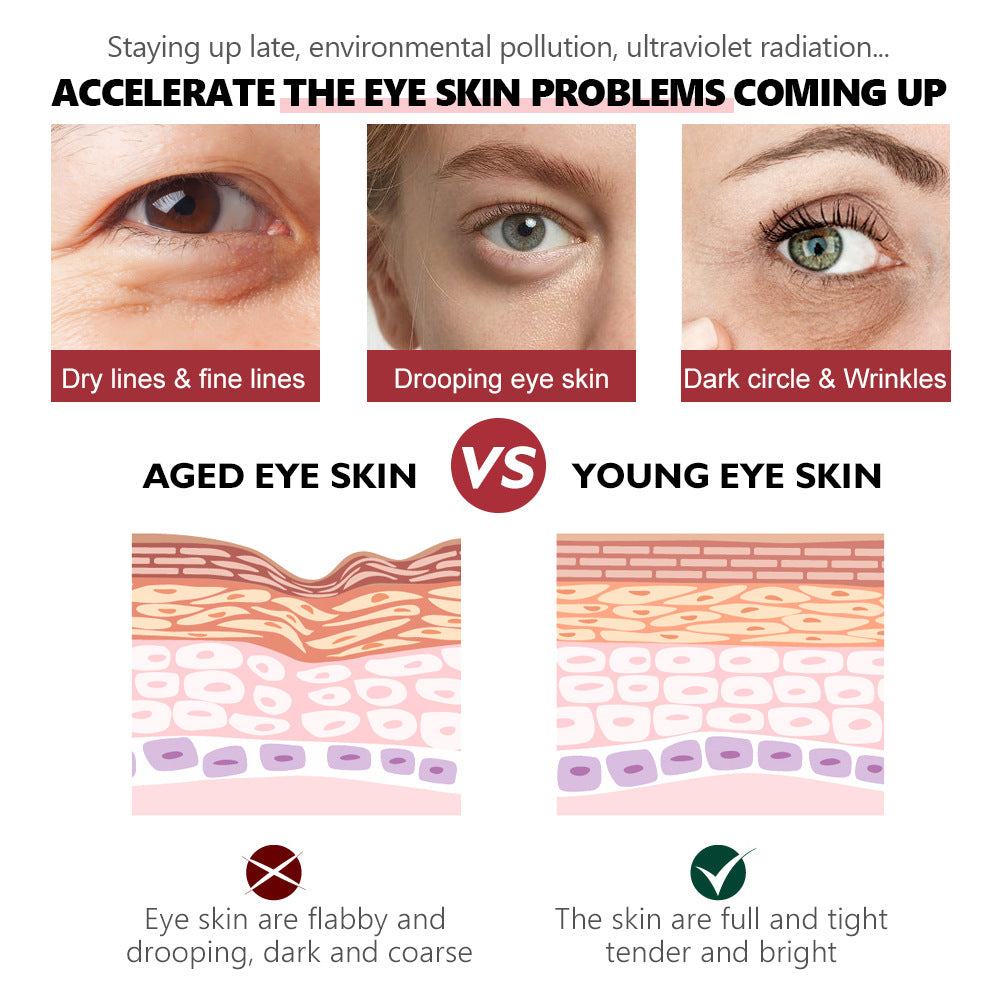 Infographic comparing aged vs. young eye skin, showing photos of wrinkles and skin-layer diagrams for rejuvenation.