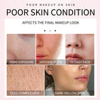 Collage showing five close-up images of skin conditions labeled pore exposure, xerosis, glossiness, dullness, and yellowing.
