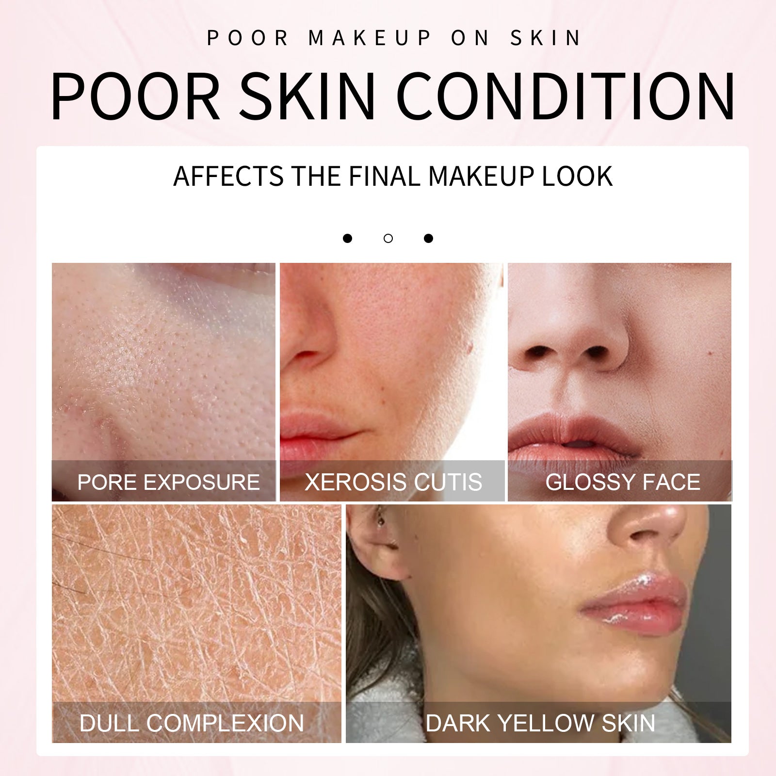 Collage showing five close-up images of skin conditions labeled pore exposure, xerosis, glossiness, dullness, and yellowing.